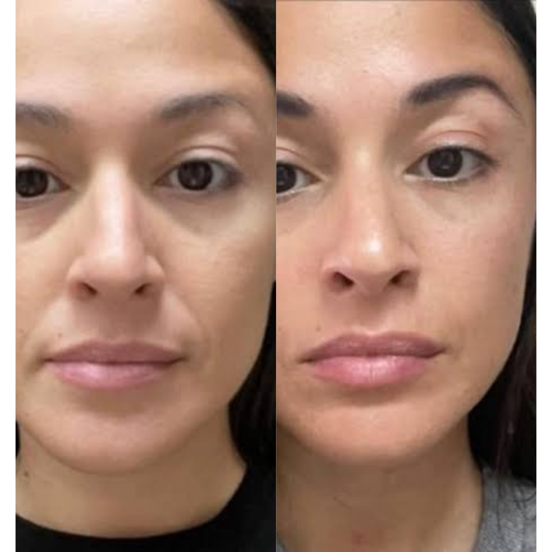 Volume Cream