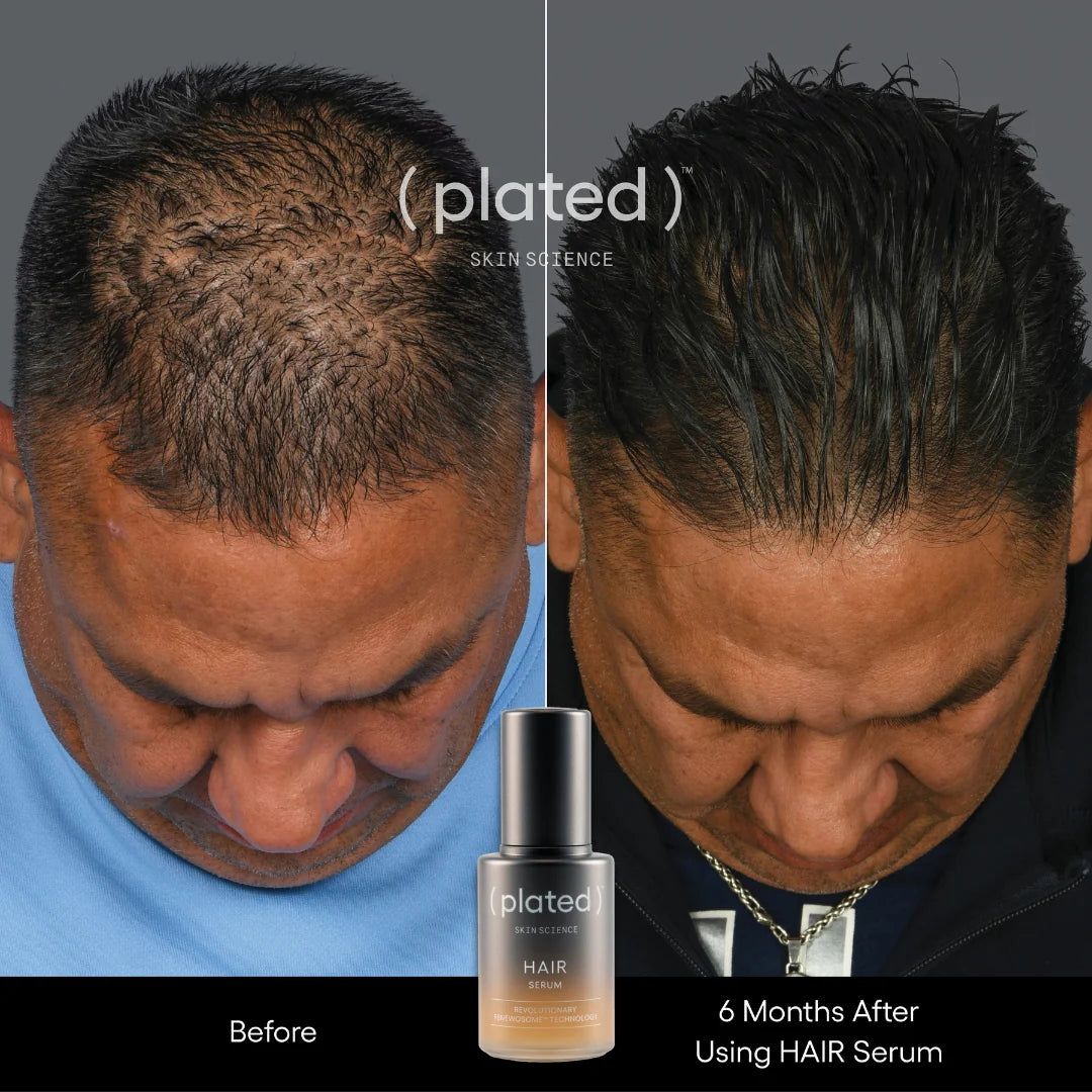 HAIR Serum