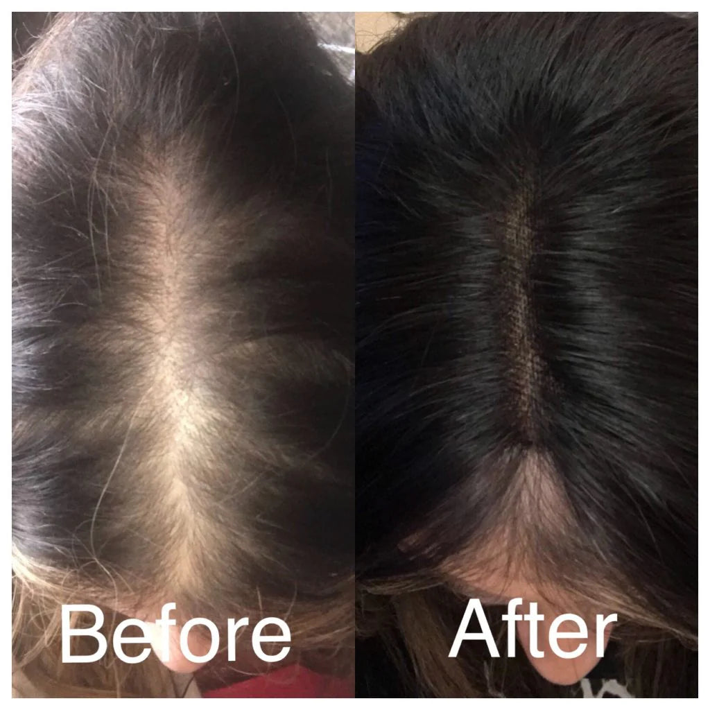 HAIR Serum