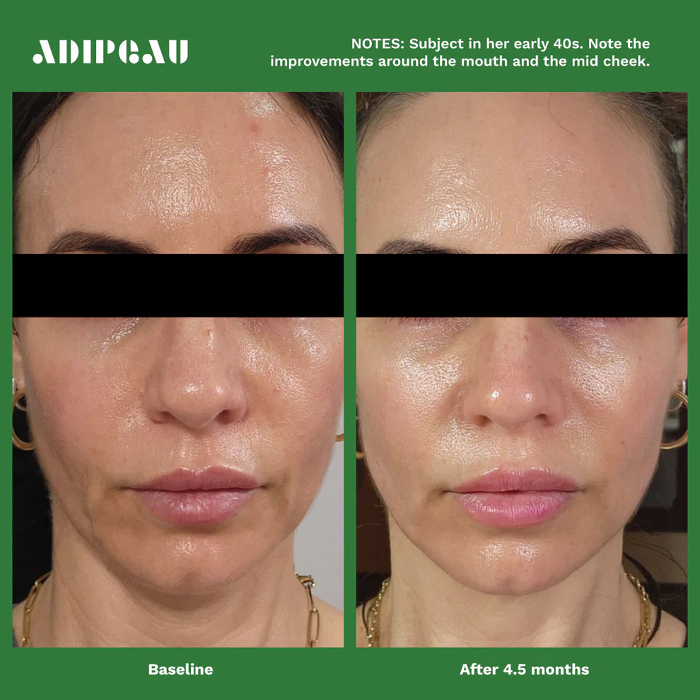 Volume Cream